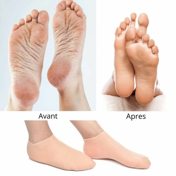 Chaussette Silicone Nuit Sandy Confort Chaussette Silicone Nuit Sandy Confort
