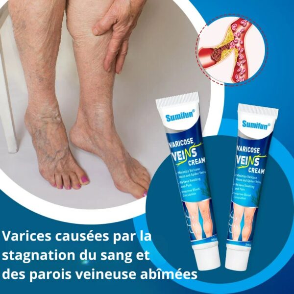 VariStop: Dites Adieu aux Varices VariStop: Dites Adieu aux Varices